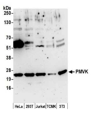Western Blot: PMVK/phosphomevalonate kinase Antibody [NBP2-59122] - Detection of human and mouse PMVK by western blot. Samples: Whole cell lysate (50 ug) from HeLa, 293T, Jurkat, mouse TCMK-1, and mouse NIH3T3 cells prepared using NETN lysis buffer. Antibody: Affinity purified rabbit anti-PMVK antibody NBP2-59122 used for WB at 1:1000. Detection: Chemiluminescence with an exposure time of 3 seconds.