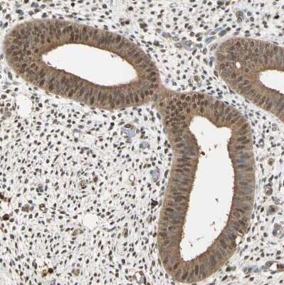 Immunohistochemistry-Paraffin: PNCK Antibody [NBP1-86652] - Staining of human endometrium shows moderate cytoplasmic positivity in glandular cells.