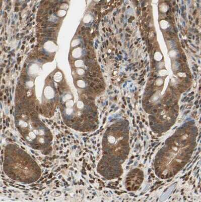 Immunohistochemistry-Paraffin: PNCK Antibody [NBP1-86652] - Staining of human small intestine shows moderate cytoplasmic positivity in glandular cells.