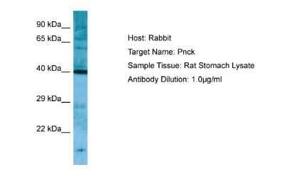 Western Blot PNCK Antibody - BSA Free