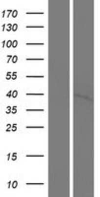 Western Blot: PNCK Overexpression Lysate (Adult Normal) [NBP2-10232] Left-Empty vector transfected control cell lysate (HEK293 cell lysate); Right -Over-expression Lysate for PNCK.