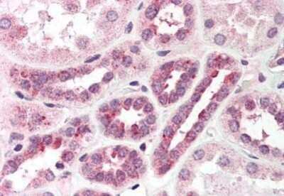 Immunohistochemistry-Paraffin: PNK Antibody [NBP1-02450] - Staining of human kidney. Immunohistochemistry of formalin-fixed, paraffin-embedded tissue after heat-induced antigen retrieval. Antibody concentration 5 ug/ml.