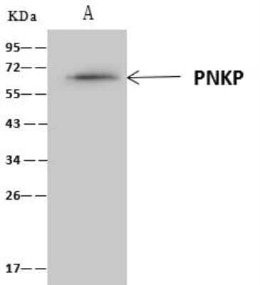 Immunoprecipitation: PNK Antibody [NBP3-12588] - Lane A:0.5 mg HeLa Whole Cell Lysate4 uL anti-PNKP rabbit polyclonal antibody and 60 ug of Immunomagnetic beads Protein A/G.Primary antibody:Anti-PNKP rabbit polyclonal antibody,at 1:100 dilution Secondary antibody:Clean-Blot IP Detection Reagent (HRP) at 1:1000dilutionDeveloped using the ECL technique.Performed under reducing conditions.Predicted band size: 57 kDaObserved band size :60 kDa