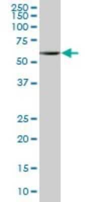 Western Blot: PNK Antibody [H00011284-B01P] - Analysis of PNKP expression in human spleen.