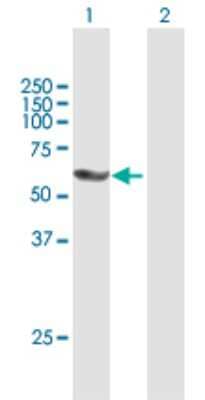 Western Blot: PNK Antibody [H00011284-B01P] - Analysis of PNKP expression in transfected 293T cell line by PNKP polyclonal antibody.  Lane 1: PNKP transfected lysate(57.31 KDa). Lane 2: Non-transfected lysate.