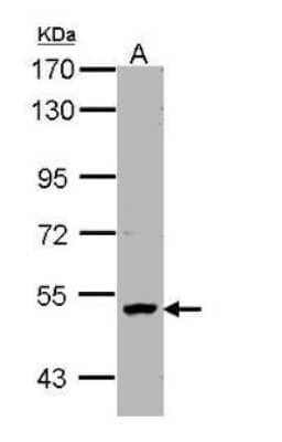 Western Blot: PNK Antibody [NBP1-32764] - Sample (30 ug of whole cell lysate) A: H1299 7.5% SDS PAGE diluted at 1:1000