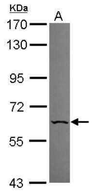 Western Blot: PNK Antibody [NBP1-32764] - Sample (30 ug of whole cell lysate) A: A549 7. 5% SDS PAGE, antibody diluted at 1:2000.