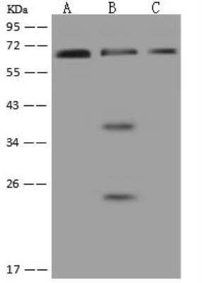 Western Blot: PNK Antibody [NBP3-12588] - Lane A: HeLa Whole Cell LysateLane B: Jurkat Whole Cell LysateLane C: PC-3 Whole Cell LysateLysates/proteins at 30 ug per lane.SecondaryGoat Anti-Rabbit IgG (H+L)/HRP at 1/10000 dilution.Developed using the ECL technique.Performed under reducing conditions.Predicted band size:57 kDaObserved band size:60 kDa(We are unsure as to the identity of these extra bands.)