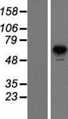 Western Blot: PNK Overexpression Lysate (Adult Normal) [NBP2-10374] Left-Empty vector transfected control cell lysate (HEK293 cell lysate); Right -Over-expression Lysate for PNK.