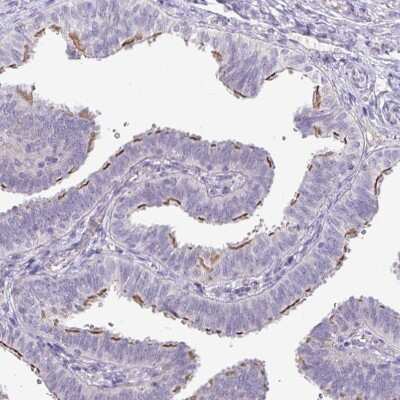Immunohistochemistry-Paraffin: PNLDC1 Antibody [NBP2-13781] - Staining of human fallopian tube shows moderate membranous positivity in glandular cells.