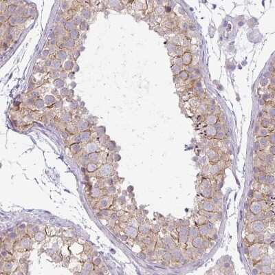 Immunohistochemistry-Paraffin: PNLDC1 Antibody [NBP2-13781] - Staining of human testis shows weak membranous positivity in cells in seminiferous ducts.