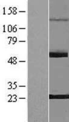 Western Blot: PNLDC1 Overexpression Lysate (Adult Normal) [NBP2-05111] Left-Empty vector transfected control cell lysate (HEK293 cell lysate); Right -Over-expression Lysate for PNLDC1.