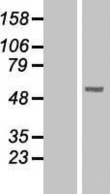 Western Blot: PNLIPRP1 Overexpression Lysate (Adult Normal) [NBL1-14544] Left-Empty vector transfected control cell lysate (HEK293 cell lysate); Right -Over-expression Lysate for PNLIPRP1.