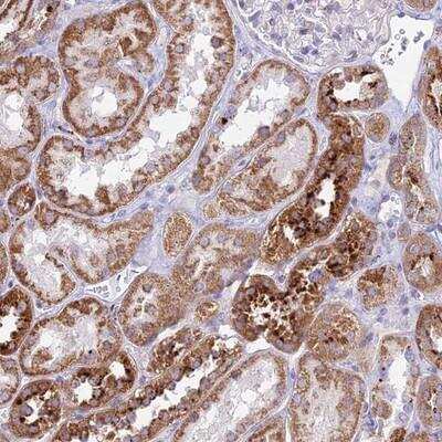 Immunohistochemistry-Paraffin: PNLIPRP3 Antibody [NBP1-94183] - Staining of human kidney shows strong cytoplasmic positivity in cells of tubules.