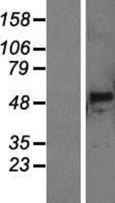 Western Blot: PNLIPRP3 Overexpression Lysate (Adult Normal) [NBP2-08787] Left-Empty vector transfected control cell lysate (HEK293 cell lysate); Right -Over-expression Lysate for PNLIPRP3.