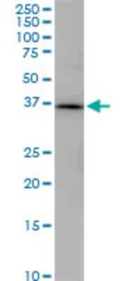 Western Blot: PNMA1 Antibody (1C3) [H00009240-M02] - PNMA1 monoclonal antibody (M02), clone 1C3. Analysis of PNMA1 expression in IMR-32.