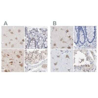Immunohistochemistry-Paraffin: PNMA1 Antibody [NBP1-82807] - Staining of human cerebral cortex, colon, hippocampus and testis using Anti-PNMA1 antibody NBP1-82807 (A) shows similar protein distribution across tissues to independent antibody NBP1-82808 (B).