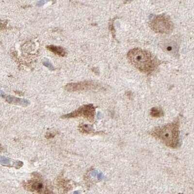 Immunohistochemistry-Paraffin: PNMA1 Antibody [NBP1-82807] - Staining of human hippocampus.