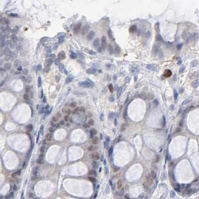 Immunohistochemistry-Paraffin: PNMA1 Antibody [NBP1-82807] - Staining of human colon.
