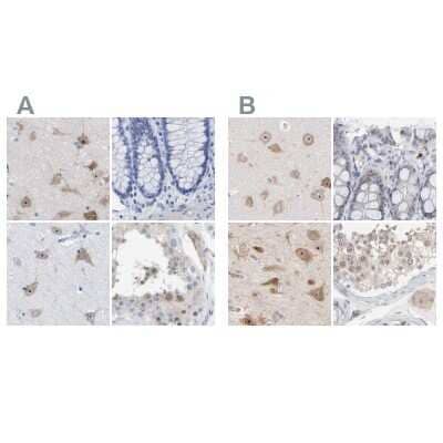 <b>Independent Antibodies Validation. </b>Immunohistochemistry-Paraffin: PNMA1 Antibody [NBP1-82808] - Staining of human cerebral cortex, colon, hippocampus and testis using Anti-PNMA1 antibody NBP1-82808 (A) shows similar protein distribution across tissues to independent antibody NBP1-82807 (B).