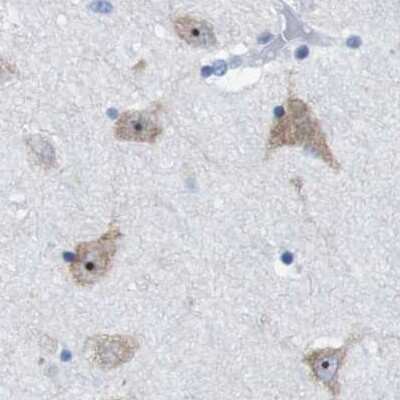 Immunohistochemistry-Paraffin: PNMA1 Antibody [NBP1-82808] - Staining of human hippocampus.