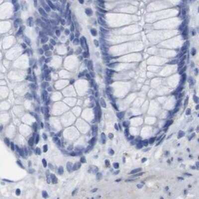 Immunohistochemistry-Paraffin: PNMA1 Antibody [NBP1-82808] - Staining of human colon.