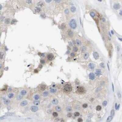 Immunohistochemistry-Paraffin: PNMA1 Antibody [NBP1-82808] - Staining of human testis.