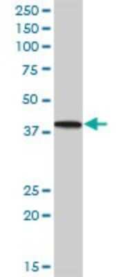 Western Blot: PNMA1 Antibody [H00009240-B01P] - Analysis of PNMA1 expression in human pancreas.
