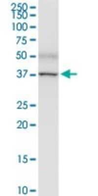 Western Blot: PNMA1 Antibody [H00009240-D01P] - Analysis of PNMA1 expression in human stomach.