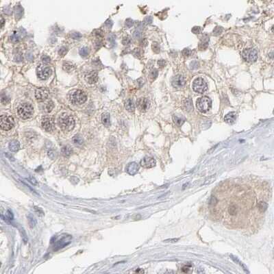 Western Blot: PNMA1 Antibody [NBP1-82807] - Staining of human testis.