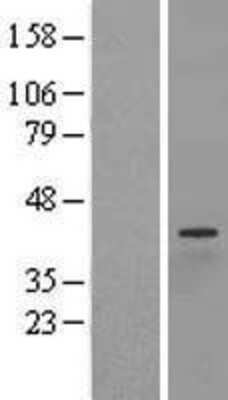 Western Blot: PNMA1 Overexpression Lysate (Adult Normal) [NBL1-14546] Left-Empty vector transfected control cell lysate (HEK293 cell lysate); Right -Over-expression Lysate for PNMA1.