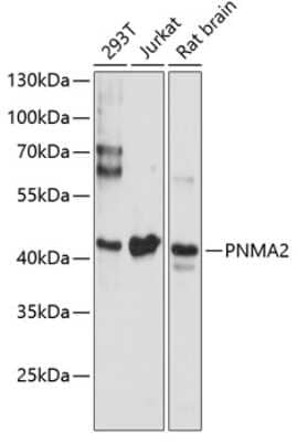 Western Blot: PNMA2 Antibody [NBP2-93328] - Analysis of extracts of various cell lines, using PNMA2 . Exposure time: 90s.