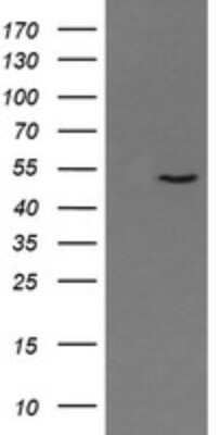 Western Blot: PNMA3 Antibody (2E6) [NBP2-46460] - Analysis of HEK293T cells were transfected with the pCMV6-ENTRY control (Left lane) or pCMV6-ENTRY PNMA3.