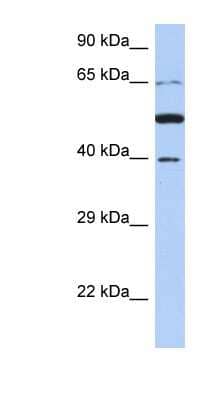 Western Blot: PNMA3 Antibody [NBP1-52929] - Titration: 0.2-1 ug/ml, Positive Control: 721_B cell lysate.