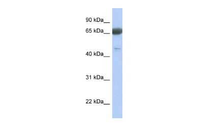 Western Blot: PNMA3 Antibody [NBP3-09330] - Western blot analysis using NBP3-09330 on Human Lung  as a positive control. Antibody Titration: 0.2-1 ug/ml