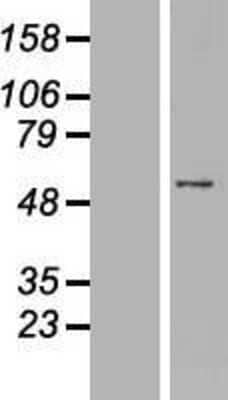 Western Blot: PNMA3 Overexpression Lysate (Adult Normal) [NBP2-07424] Left-Empty vector transfected control cell lysate (HEK293 cell lysate); Right -Over-expression Lysate for PNMA3.