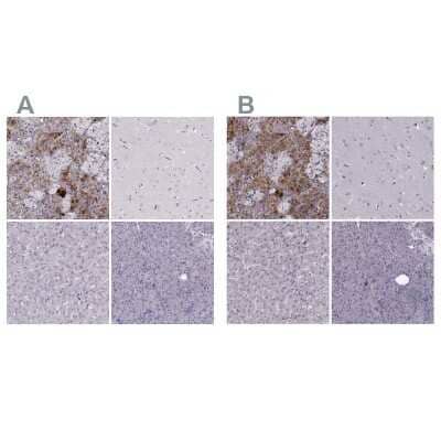 <b>Independent Antibodies Validation and Orthogonal Strategies Validation.</b>Immunohistochemistry-Paraffin: PNMT Antibody [NBP2-33392] - Staining of human adrenal gland, cerebral cortex, liver and pancreas using Anti-PNMT antibody NBP2-33392 (A) shows similar protein distribution across tissues to independent antibody NBP2-33602 (B).