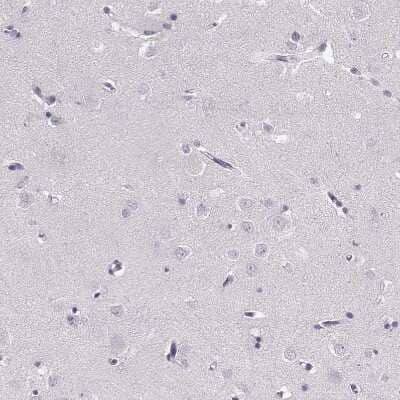 Immunohistochemistry-Paraffin: PNMT Antibody [NBP2-33392] - Staining of human cerebral cortex shows no positivity in neurons as expected.