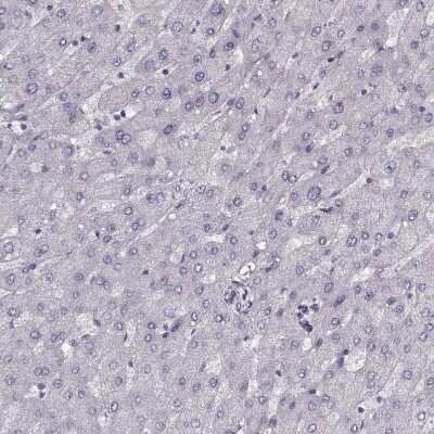 Immunohistochemistry-Paraffin: PNMT Antibody [NBP2-33392] - Staining of human liver shows no positivity in hepatocytes as expected.