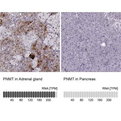 Immunohistochemistry-Paraffin: PNMT Antibody [NBP2-33392] - Staining in human adrenal gland and pancreas tissues using NBP2-33392 antibody. Corresponding PNMT RNA-seq data are presented for the same tissues.