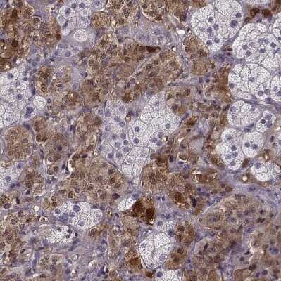 Immunohistochemistry-Paraffin: PNMT Antibody [NBP2-33602] - Staining of human adrenal gland shows moderate to strong cytoplasmic positivity.