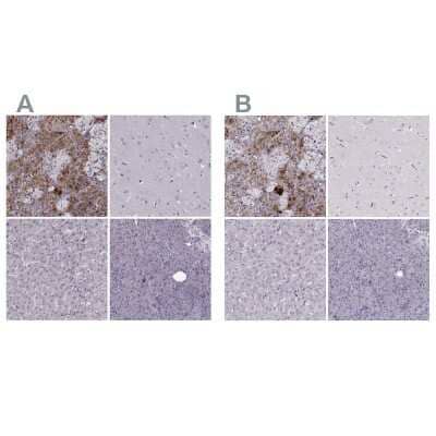 <b>Independent Antibodies Validation. </b>Immunohistochemistry-Paraffin: PNMT Antibody [NBP2-33602] - Staining of human adrenal gland, cerebral cortex, liver and pancreas using Anti-PNMT antibody NBP2-33602 (A) shows similar protein distribution across tissues to independent antibody NBP2-33392 (B).