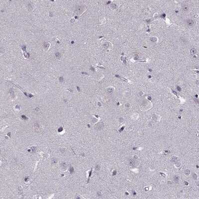 Immunohistochemistry-Paraffin: PNMT Antibody [NBP2-33602] - Staining of human cerebral cortex shows no positivity in neurons as expected.