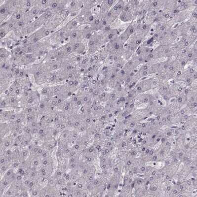 Immunohistochemistry-Paraffin: PNMT Antibody [NBP2-33602] - Staining of human liver shows no positivity in hepatocytes as expected.