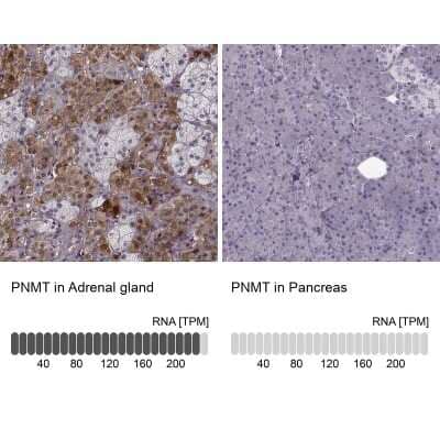 <b>Orthogonal Strategies Validation. </b>Immunohistochemistry-Paraffin: PNMT Antibody [NBP2-33602] - Staining in human adrenal gland and pancreas tissues using NBP2-33602 antibody. Corresponding PNMT RNA-seq data are presented for the same tissues.