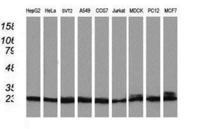 Western Blot: PNMT Antibody (OTI1D2) - Azide and BSA Free [NBP2-73494] - Analysis of extracts (35ug) from 9 different cell lines by using anti-PNMT monoclonal antibody.