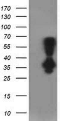 Western Blot: PNMT Antibody (OTI1D2) - Azide and BSA Free [NBP2-73494] - HEK293T cells were transfected with the pCMV6-ENTRY control (Left lane) or pCMV6-ENTRY PNMT (Right lane) cDNA for 48 hrs and lysed. Equivalent amounts of cell lysates (5 ug per lane) were separated by SDS-PAGE and immunoblotted with anti-PNMT.