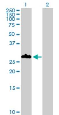Western Blot: PNMT Antibody [H00005409-D01P] - Analysis of PNMT expression in transfected 293T cell line by PNMT polyclonal antibody.Lane 1: PNMT transfected lysate(30.90 KDa).Lane 2: Non-transfected lysate.