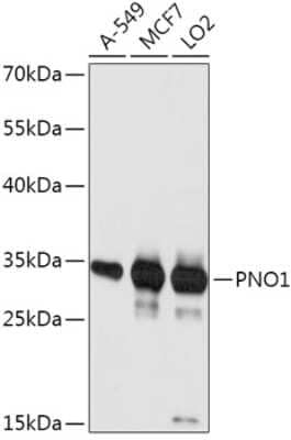 Western Blot: PNO1 Antibody [NBP2-94387] - Analysis of extracts of various cell lines, using PNO1 at 1:1000 dilution. Secondary antibody: HRP Goat Anti-Rabbit IgG (H+L) at 1:10000 dilution. Lysates/proteins: 25ug per lane. Blocking buffer: 3% nonfat dry milk in TBST. Detection: ECL Basic Kit . Exposure time: 10s.