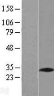 Western Blot: PNO1 Overexpression Lysate (Adult Normal) [NBL1-14552] Left-Empty vector transfected control cell lysate (HEK293 cell lysate); Right -Over-expression Lysate for PNO1.